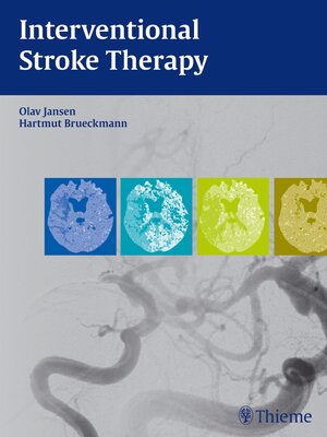 cover image of Interventional Stroke Therapy